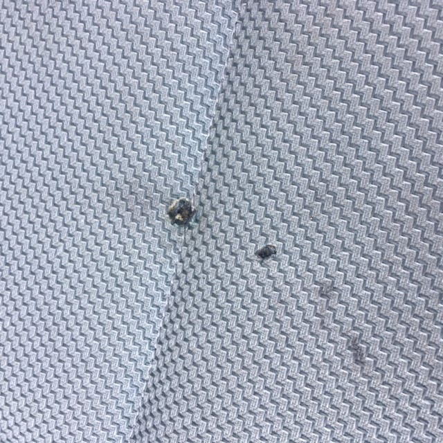 Sigara yanığı tamiri önce